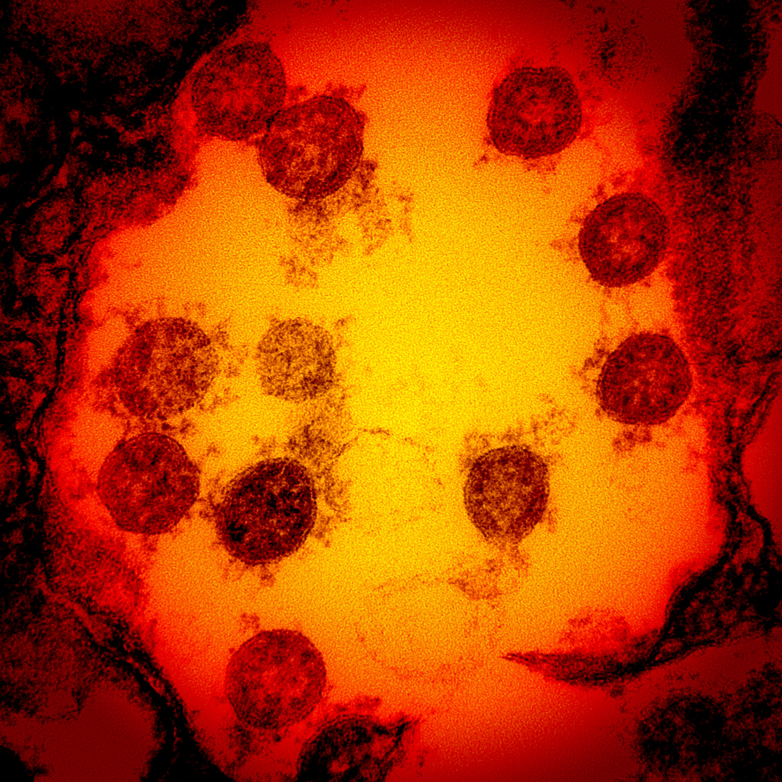 Novel Coronavirus SARS-CoV-2